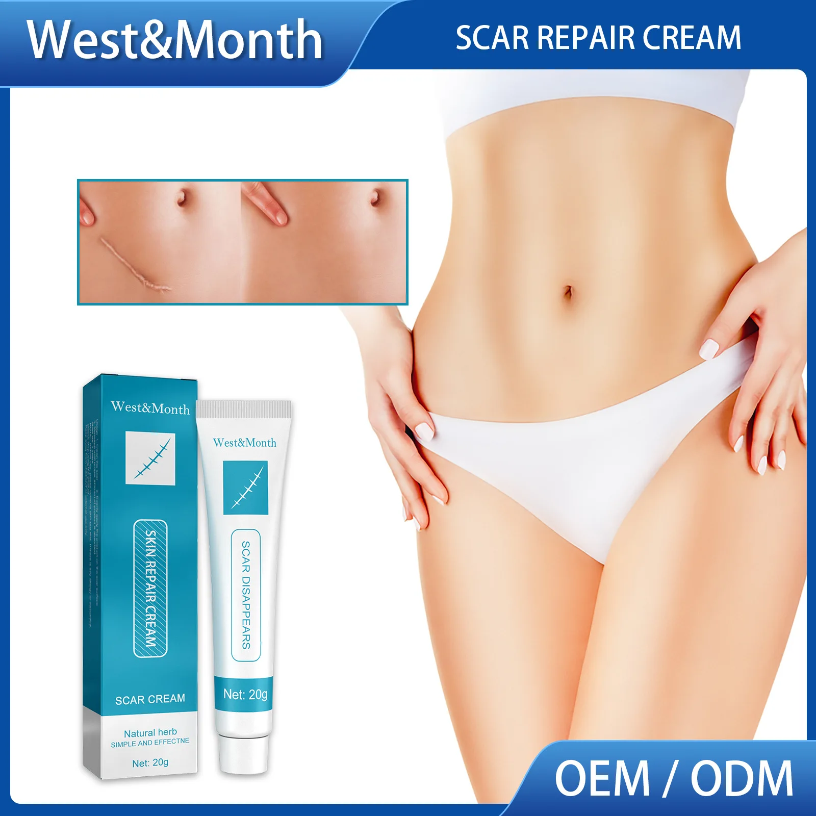 Крем травяной для удаления шрамов от растяжек Устранение пятен акне лечение