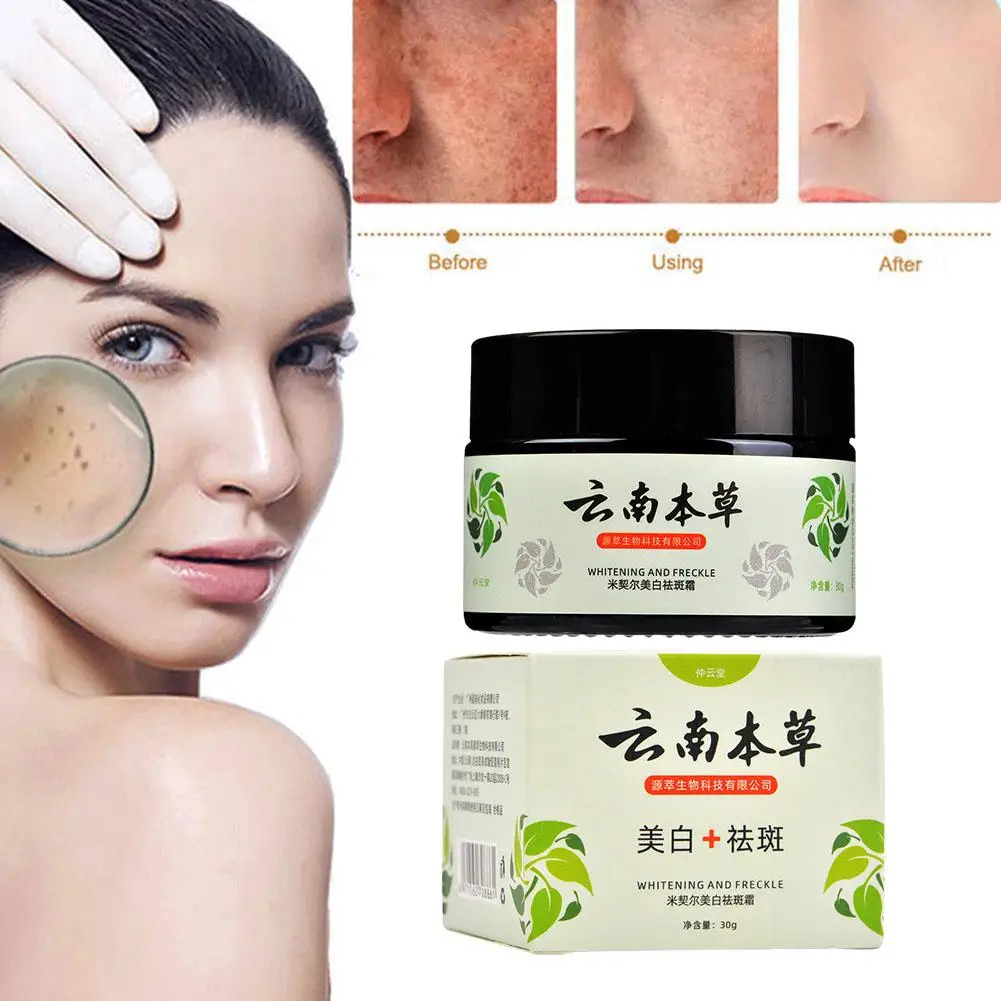 

Yunnan Herbal Whitening And Freckle Removing Cream Stain Sunburn Face Moisturizing Freckle Lightening Cream Lighten Chloasm F5Y6