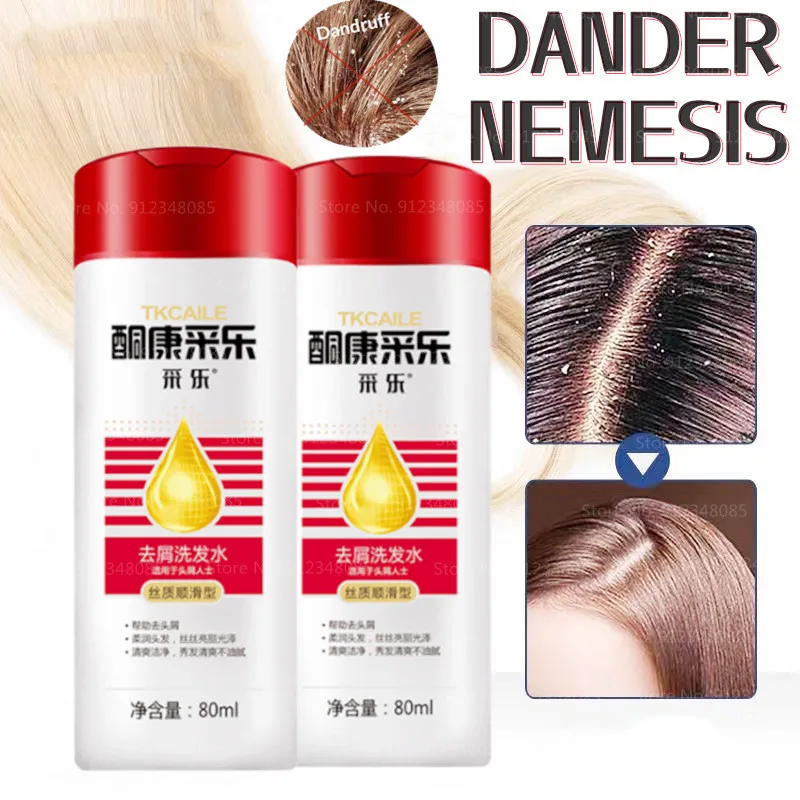 

Refreshing Oil Control Anti-dandruff Shampoo 80ml Dandruff Head Anti-itch Shampoo Men and Women Shampoo Soft and Smooth