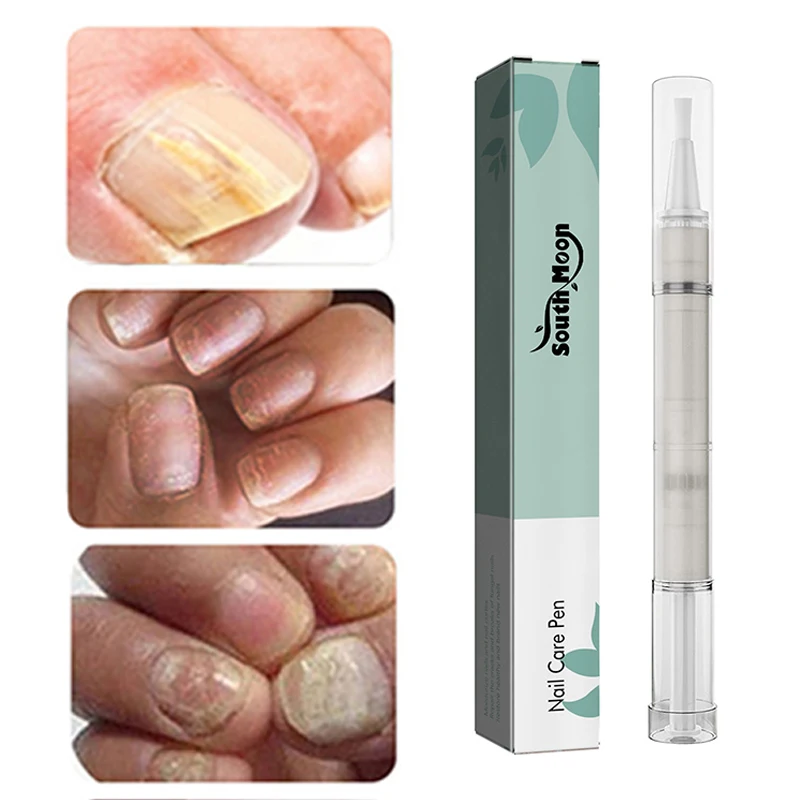 Fungal Anti Fungus Biological Repair Nail Repair Fluid Cuticle Oil