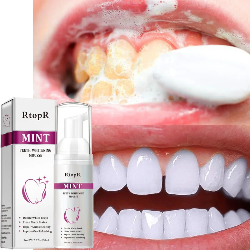 

RtopR Teeth Whitening Remove Smoke Stains Coffee Stains Fresh Breath Bad Breath Clean Teeth Stains Dazzle White Teeth 1pcs 60ml