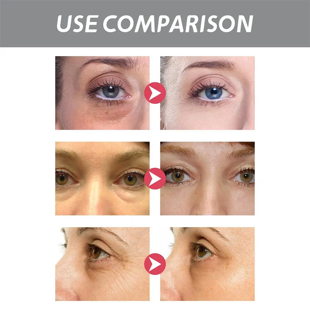 Рисунок 6 - антивозрастной крем для области вокруг глаз