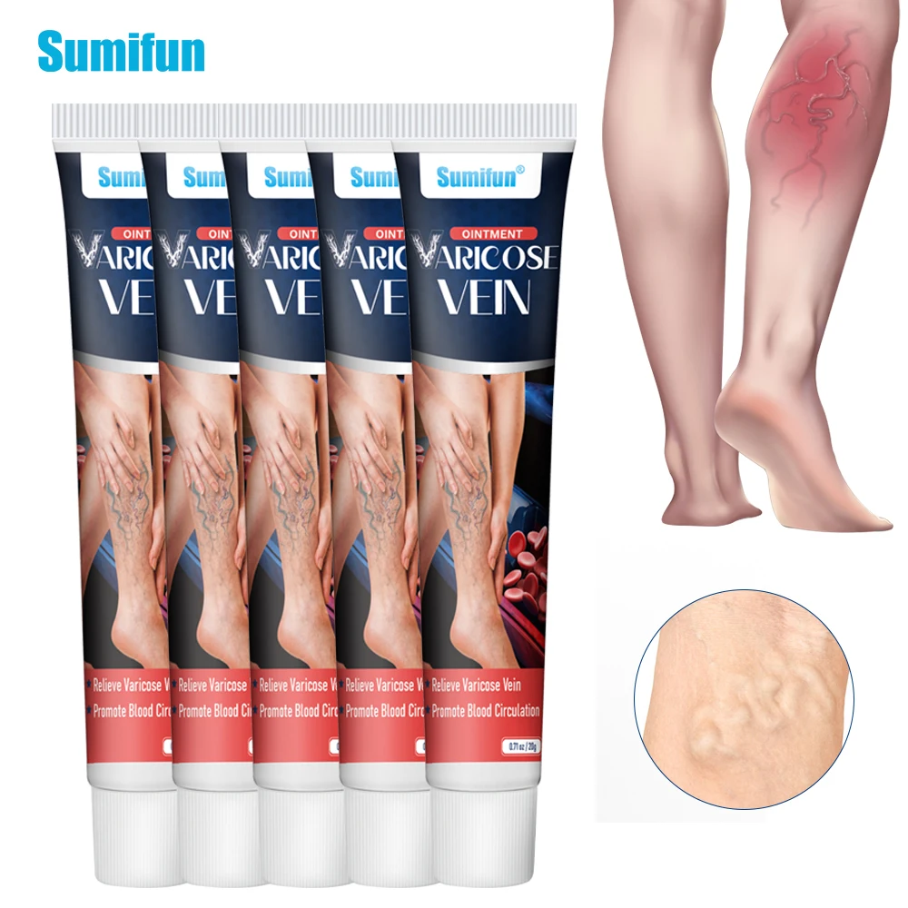 

1/3/5Pcs Sumifun Varicose Vein Cream Relieve Vasculitis Phlebitis Spider Leg Swelling Plaster Varicosity Angiitis Pain Relief