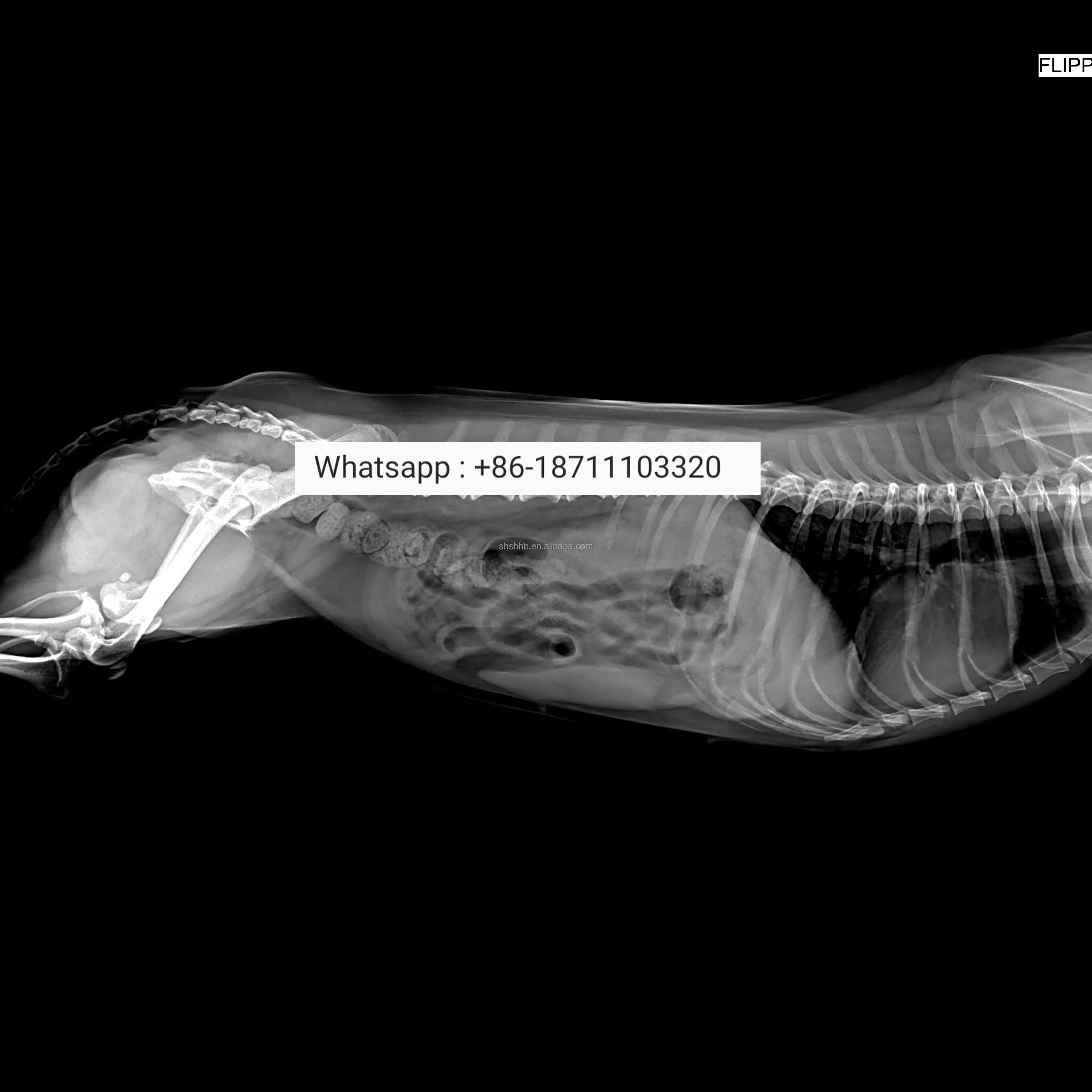 Рисунок 5 - Детектор рентгеновских снимков
