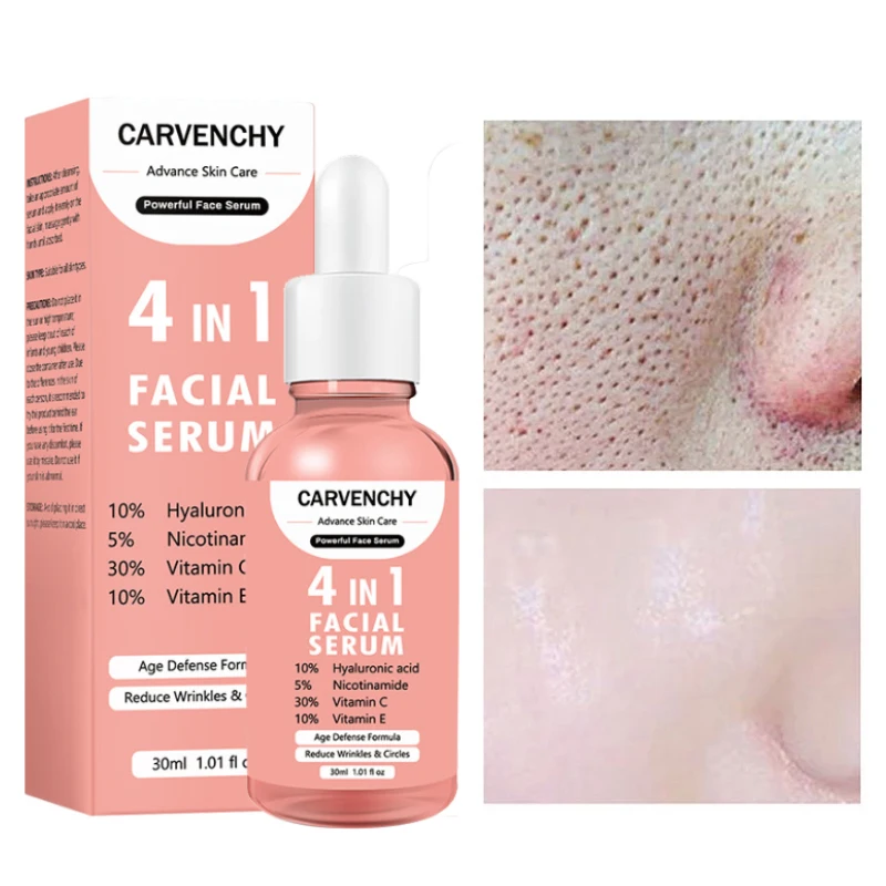 

Vitamin C Face Serum Care Whitening Lighten Spots Facial Skin Essence Fade Dark Spots Remove Freckle Skin Care Products 30ml