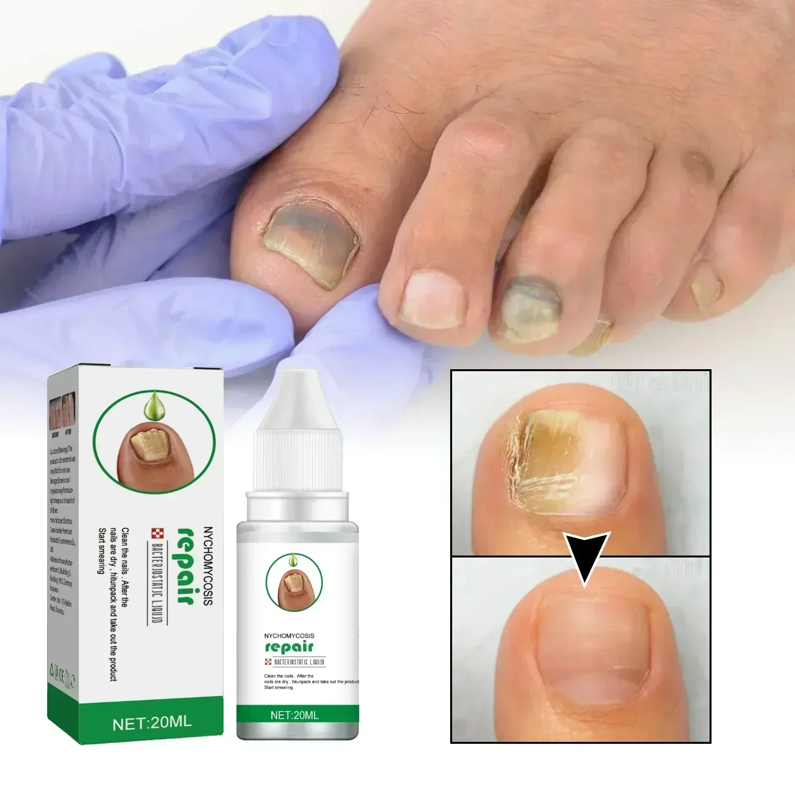 5 Fungals восстанавливающая жидкость для ногтей неокрашенных утолщенных разбитых