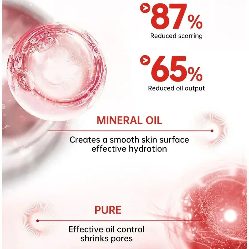 Крем для быстрого удаления шрамов травяной крем от растяжек ожогов