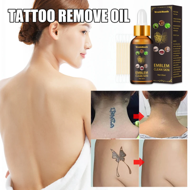 

Quick Tattoo Removal Liquid Agent Bleaching Makeup Permanent Removal Pigment Tattoo Supplies