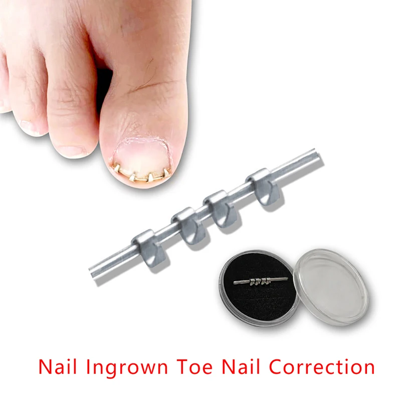 

1PCS Professional Ingrown Toe Nail Correction Wire Fixer Treatment Tool Pedicure Paronychia Recover Toenails Corrector Reusable