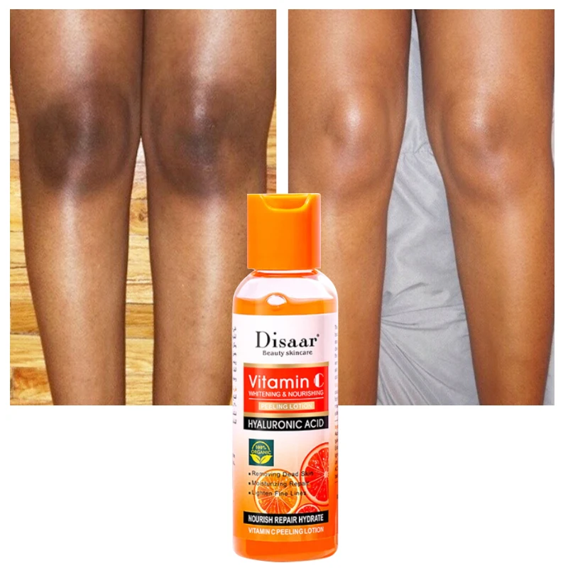 

100g Vitamin C Whitening Nourish Peeling Lotion Lighten Melanin Fingers Knees Joints Brightening Moisturizing Smooth Skin