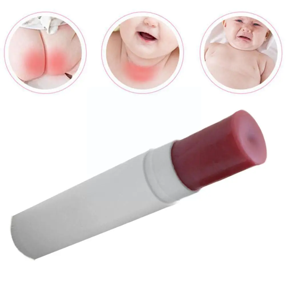 

Женский Профессиональный питательный крем для отбеливания пятен Lithospermum, крем для удаления рук, крем для быстрого удаления бедер, F9p8