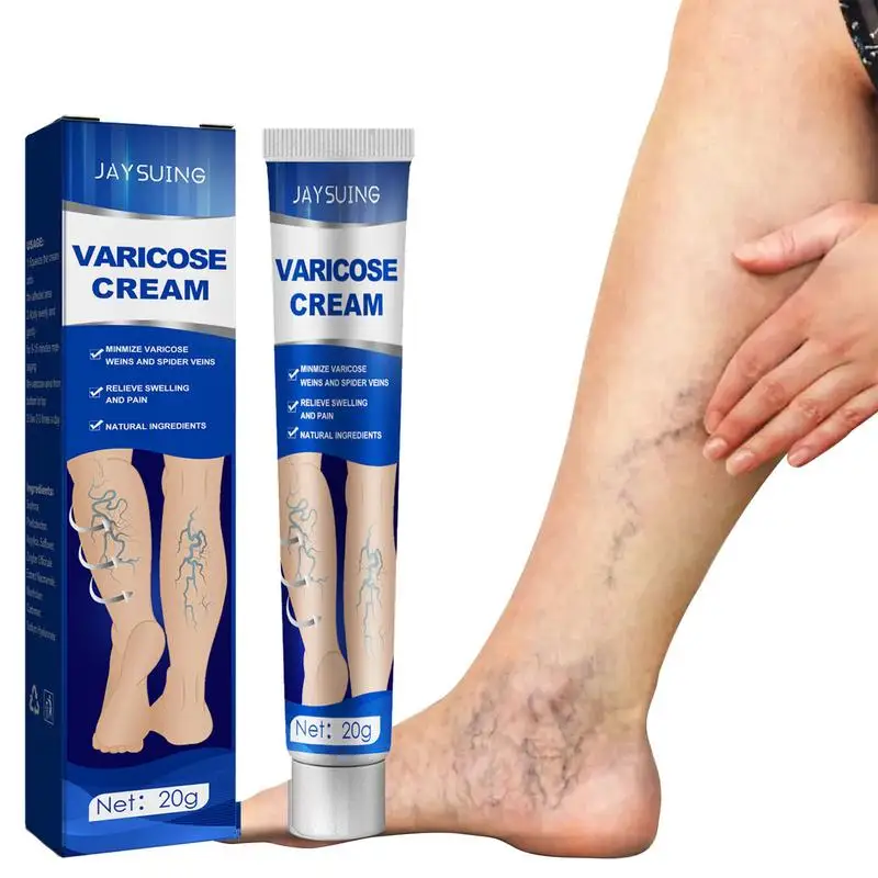 

Varicose Vein Cream Natural Ingredients Treatments Varicose Vein Ointment Medical Spider Veins Inflammation Leg Massage Cream