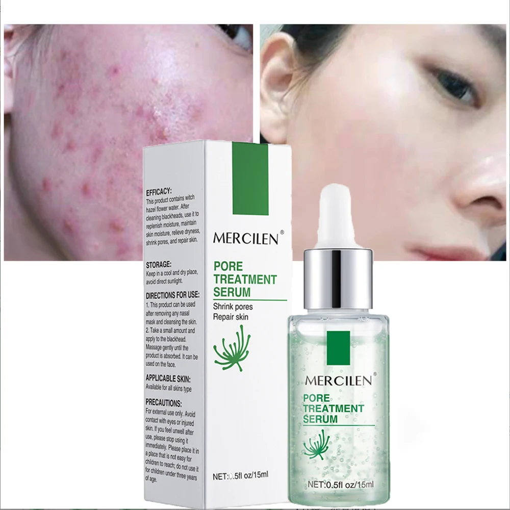 

Hyaluronic Acid Serum 24K Facial Serum Whitening Anti-Aging Hexapeptide Stock Solution Witch Hazel Remove Acne Face Care Serum