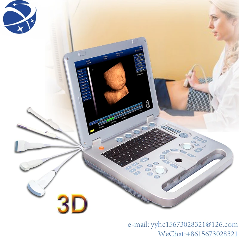 

Yun Yi Sun-800D Lage Kosten Laptop Ziekenhuis 3D Ob Gyn Echografie Machine Met Hoge Kwaliteit