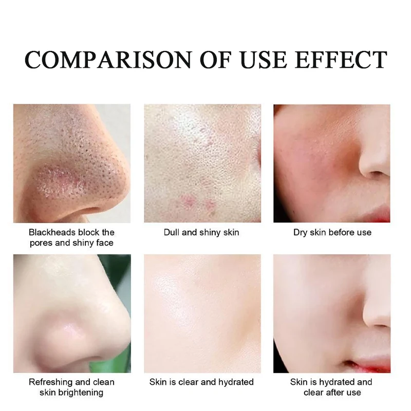 Маска для лица с носом удаления черных точек сужающая поры разрывающая полоска