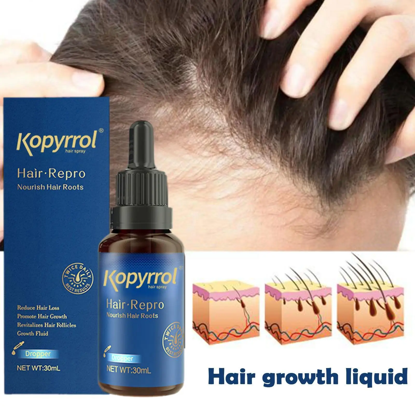 

30ml Anti-hair Loss Treatment Essence Men Women Prevent Hair Hair Loss Serum Care Growth Repair Products Root Damaged Scalp G0h8