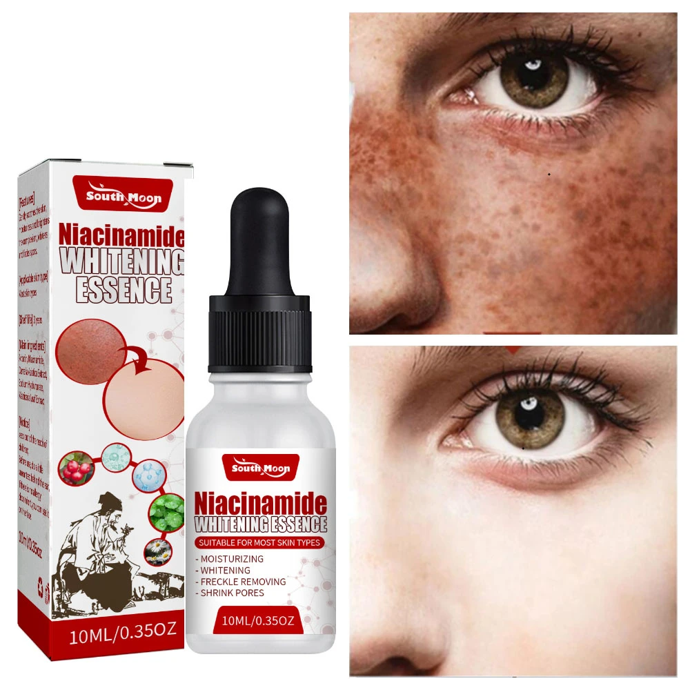 

Niacinamide Whitening Freckle Serum Remove Melasma Dark Spots Lifting Firming Improve Dullness Brighten Moisturizing Skin Care