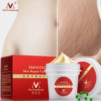 pregnancy maternity cream removes maternal skin repair body cream removes postpartum scar care gentle moisturizing smooth skin
