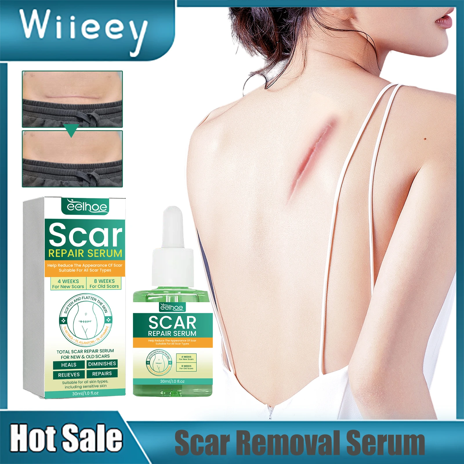 

Fade Scars Serum Repair Whitening Smoothing Removing Old Burn Surgical Scar Acne Wound Treatment Stretch Marks Removal Essence