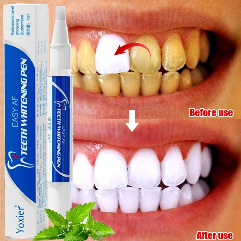 

Teeth Whitening Pen Whiten Teeth Serum Remove Plaque Stains Bleaching Cleaning Toothbrush Oral Hygiene Fresh Breath Dental Tools