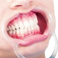 disposable cheek retractors dental mouth open