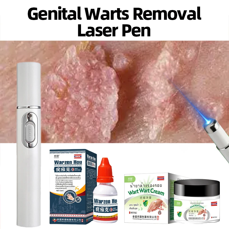 Лазерная ручка для удаления генитальных бородавок частное антибактериальное