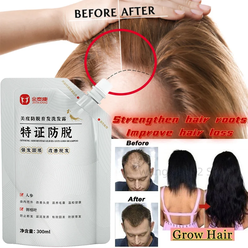 

300g Arborvitae Leaf Ginseng Anti-hair Loss Shampoo Super Anti-dandruff Oil Control Shampoo Essential for Anti-hair Loss