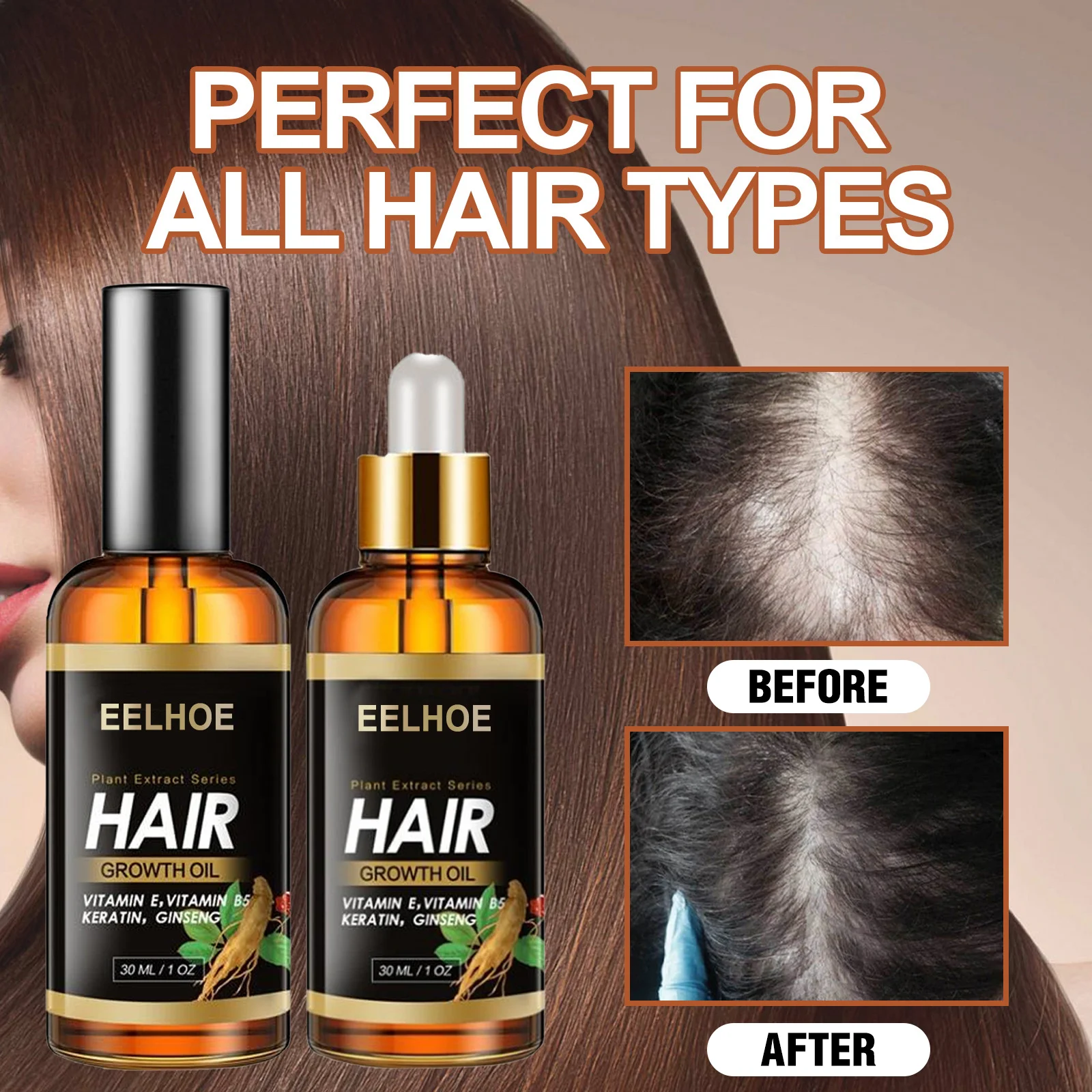 

Ginger Hair Growth Serum Essential Oil Anti Hair Loss Spray Products Treatment For Dry Frizzy Damaged Thin Hair Nourish Care