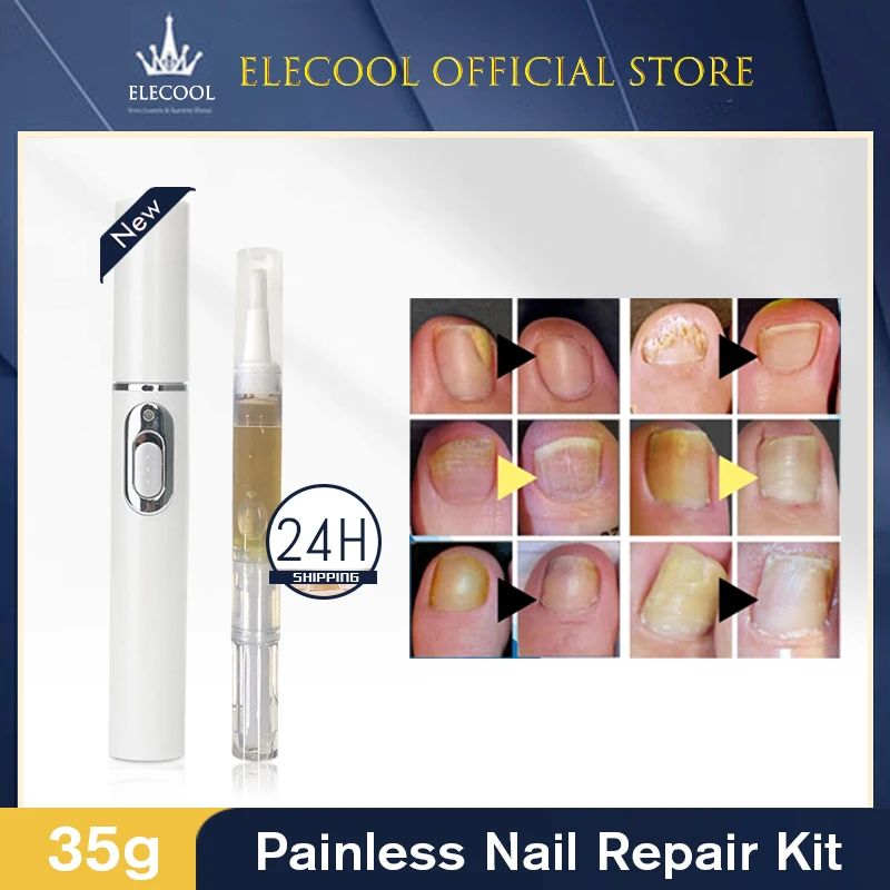 

1~5PCS Nail Anti-fungal Set Nail Laser Pen Onychomycosis Paronychia Anti Fungal Fungus Care Painless Repair Serum Kit