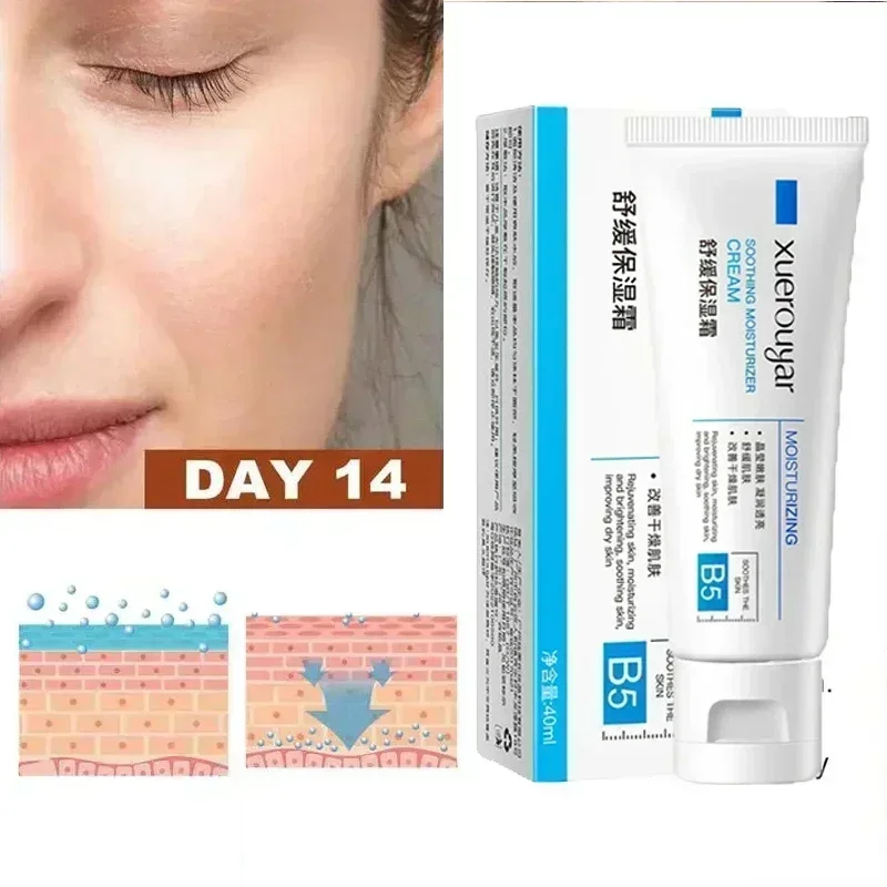 7 Day Repair Facial Redness Cream Soothing Skin Rosacea Red Blood Improve Sensitive CareKorean Cosmetic