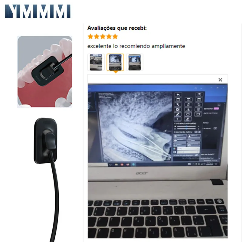 Стоматология стоматологический радиовизограф рентгенография высокочастотная