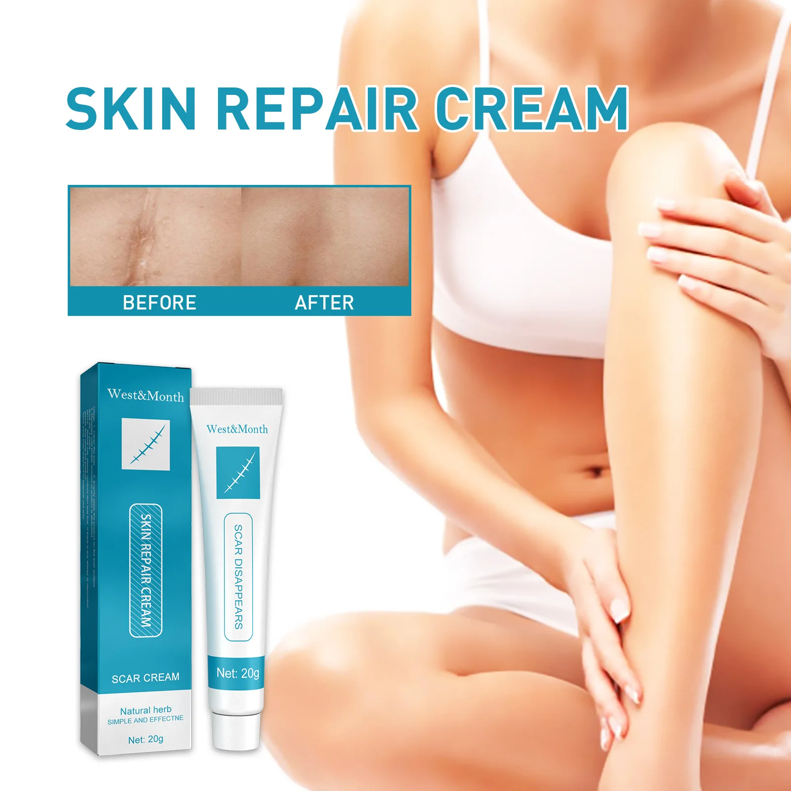 

Scar Repair Cream Herbal Lighten Burns Remove Acne Spots Burn Surgical Fade Stretch Marks Acne Treatment Smooth Skin Scar Cream
