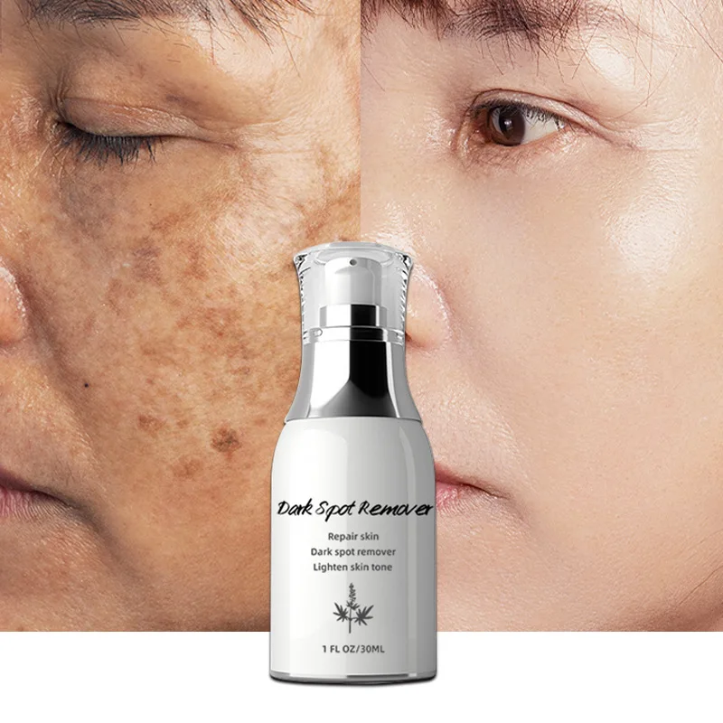 

Whitening Face Serum Care Lighten Spots Brightening Facial Skin Essence Fade Dark Spots Remove Freckle Speckle Product