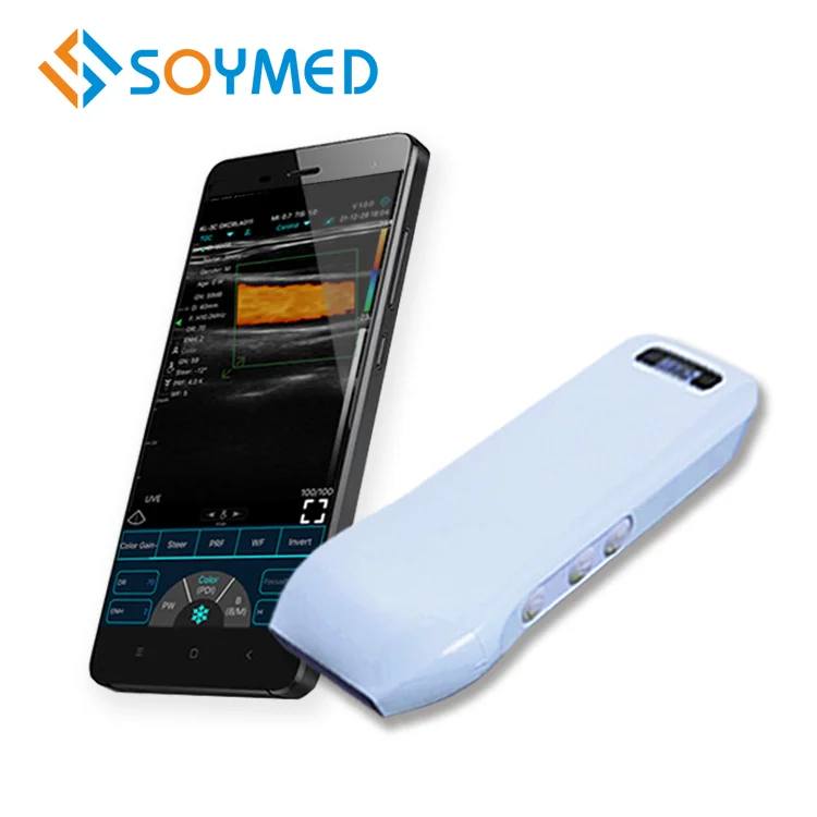 

Medical portable color doppler wireless hand held linear ultrasound instruments probe portable for Surgery and Hemodialysis