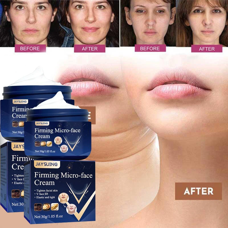 

Minus Double Chin Weight Loss Cream Lift Tighten Loose Skin Massage Cream Tighten Facial Contours Burn Fat Become A Small V-face