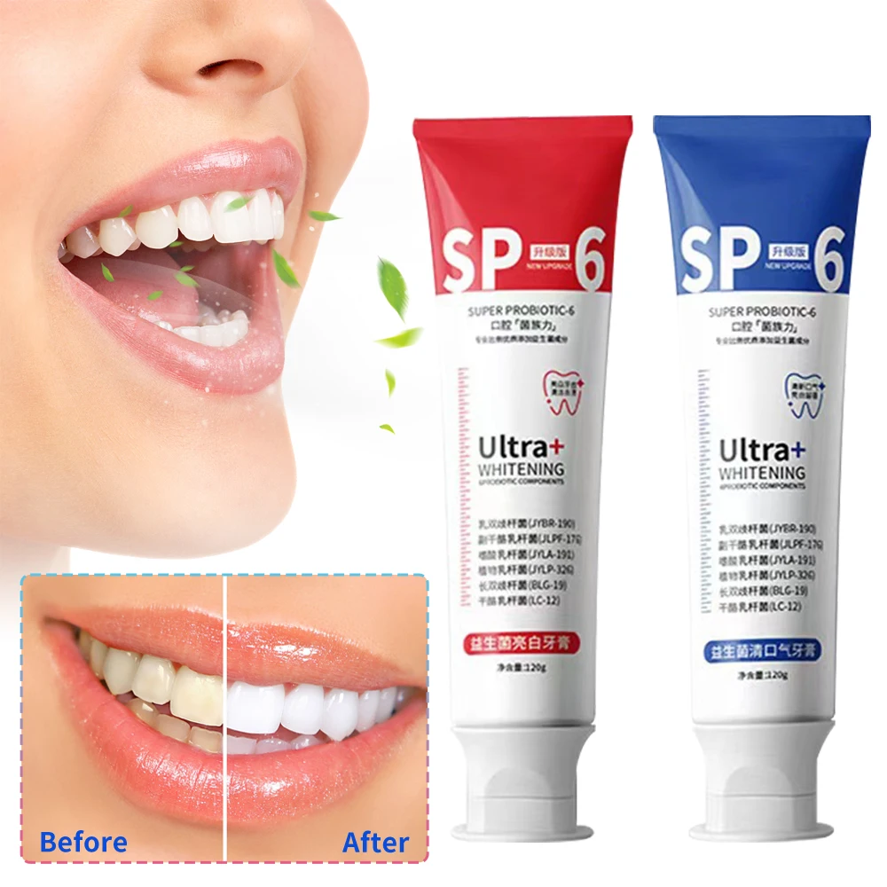 

SP-6 пробиотическая зубная паста, Sp-6 зубная паста для отбеливания, 120 г для чистки зубов