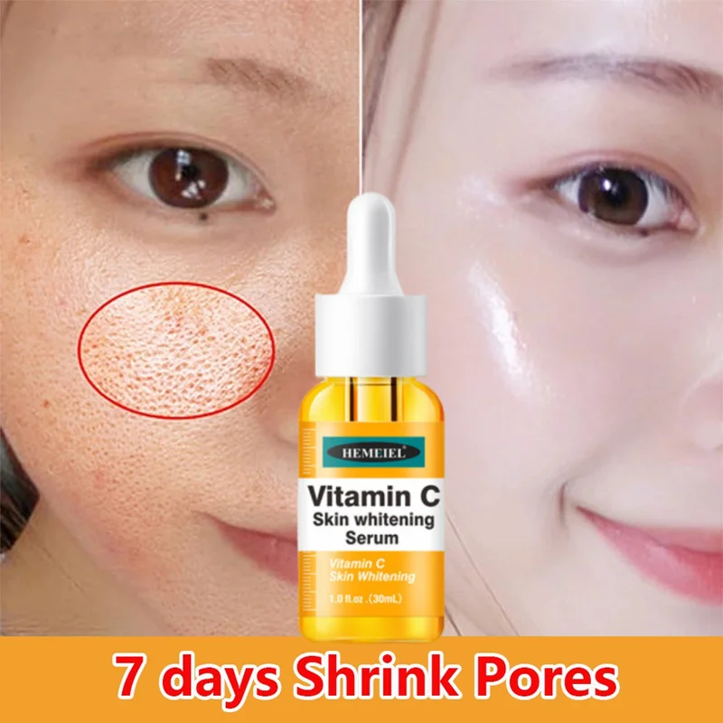 

Vitamin C Whitening Serum Melasma Dark Spot Remover for Face Essence Anti Aging Wrinkles,Shrink Pores Acne Treatment Skin Care