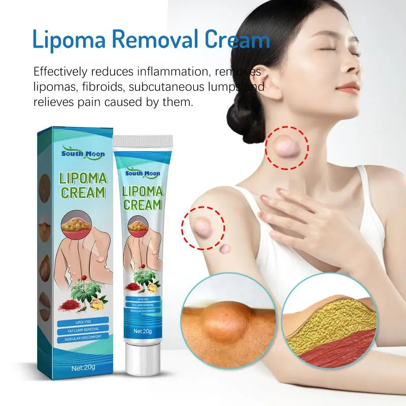 

Lipoma Removal Cream Natural Plant Extract Easy To Absorb Removes Lipomas Fibroids Subcutaneous Lumps Pain Relief Skin Care