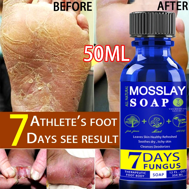 Традиционное китайское масло 50 г крем для удаления трещин и пятки