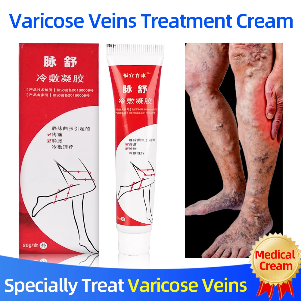 

Varicose Vein Cold Compress Gel Phlebitis/Vasculitis Treatment Ointment Varicosity Angiitis Pain/Swelling Relief Body Care Cream