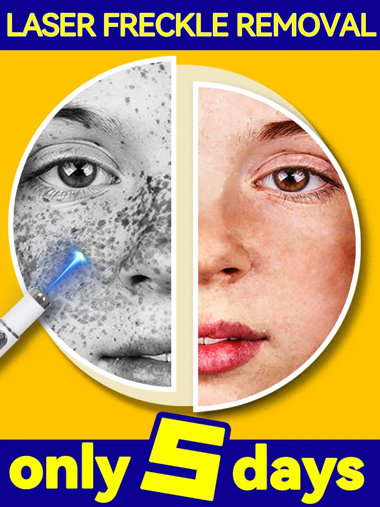 Пятна для лица исчезают