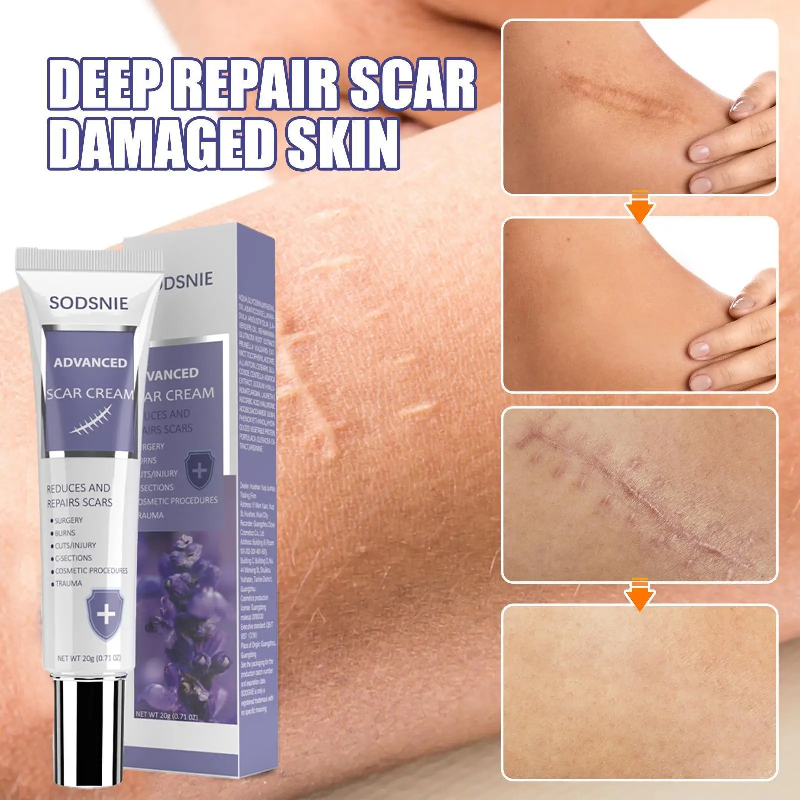 

Advanced Scar Cream Remove Acne Spots Burn Surgical Scar Treatment Smooth Nourish Repair Stretch Marks Whitening Moisturizer 20g