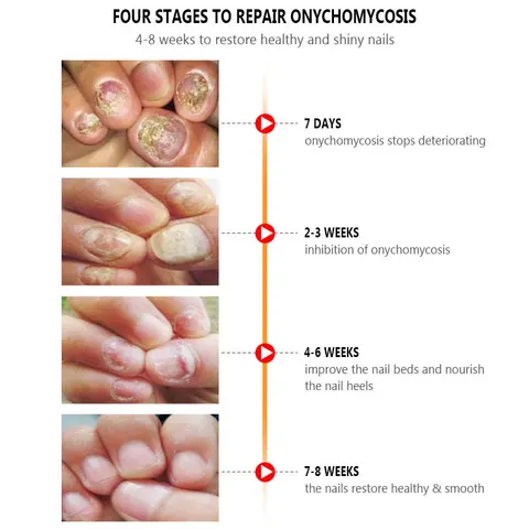 ARTISCARE Сыворотка для ногтей 20 мл