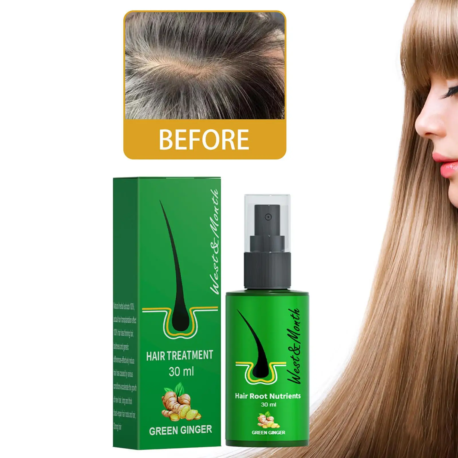 

Спрей для роста волос 30 мл против имбирного масла, питает кожу головы, волосы, восстанавливает кожу головы, улучшает мужскую кожу головы