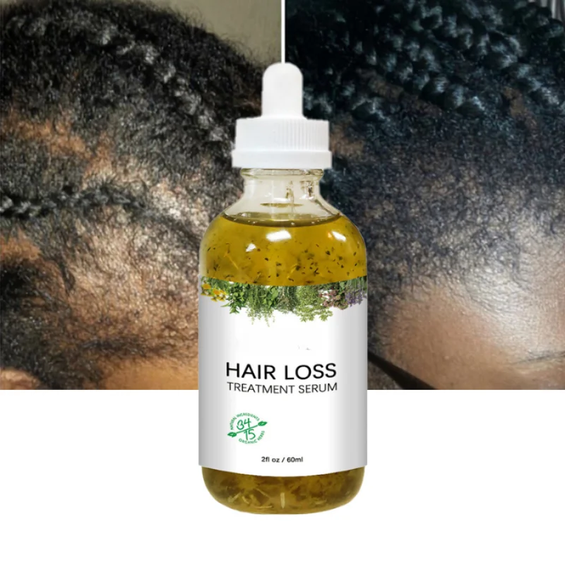

Sdotter 60ml New Arrival Smoothing Repairing Anti Loss Hair Oil Regrowth Scalp Elixirs Private Label Hair Growth Oil Serum