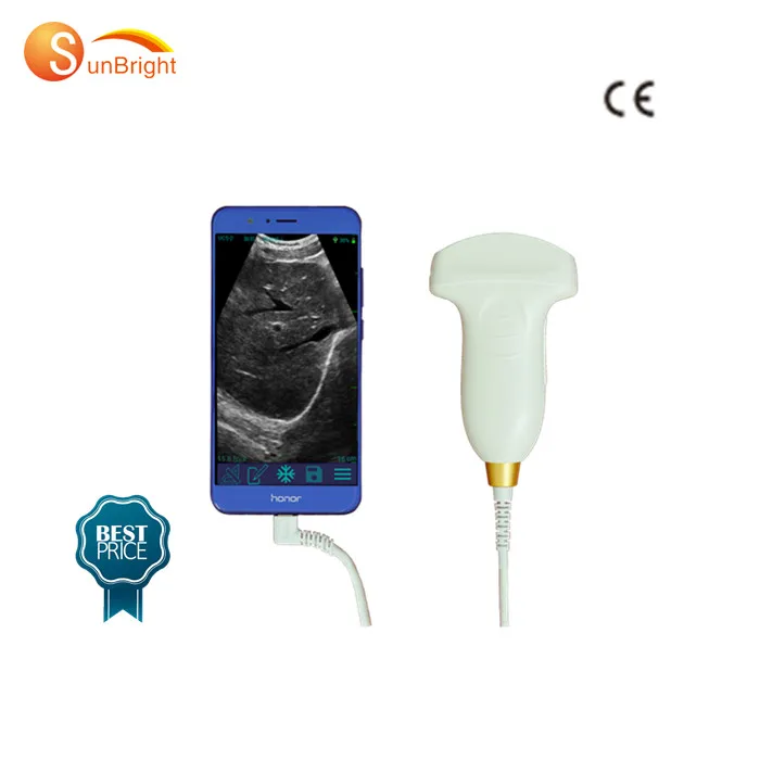 

Handheld portable wireless ultrasound diagnostic scanner probe
