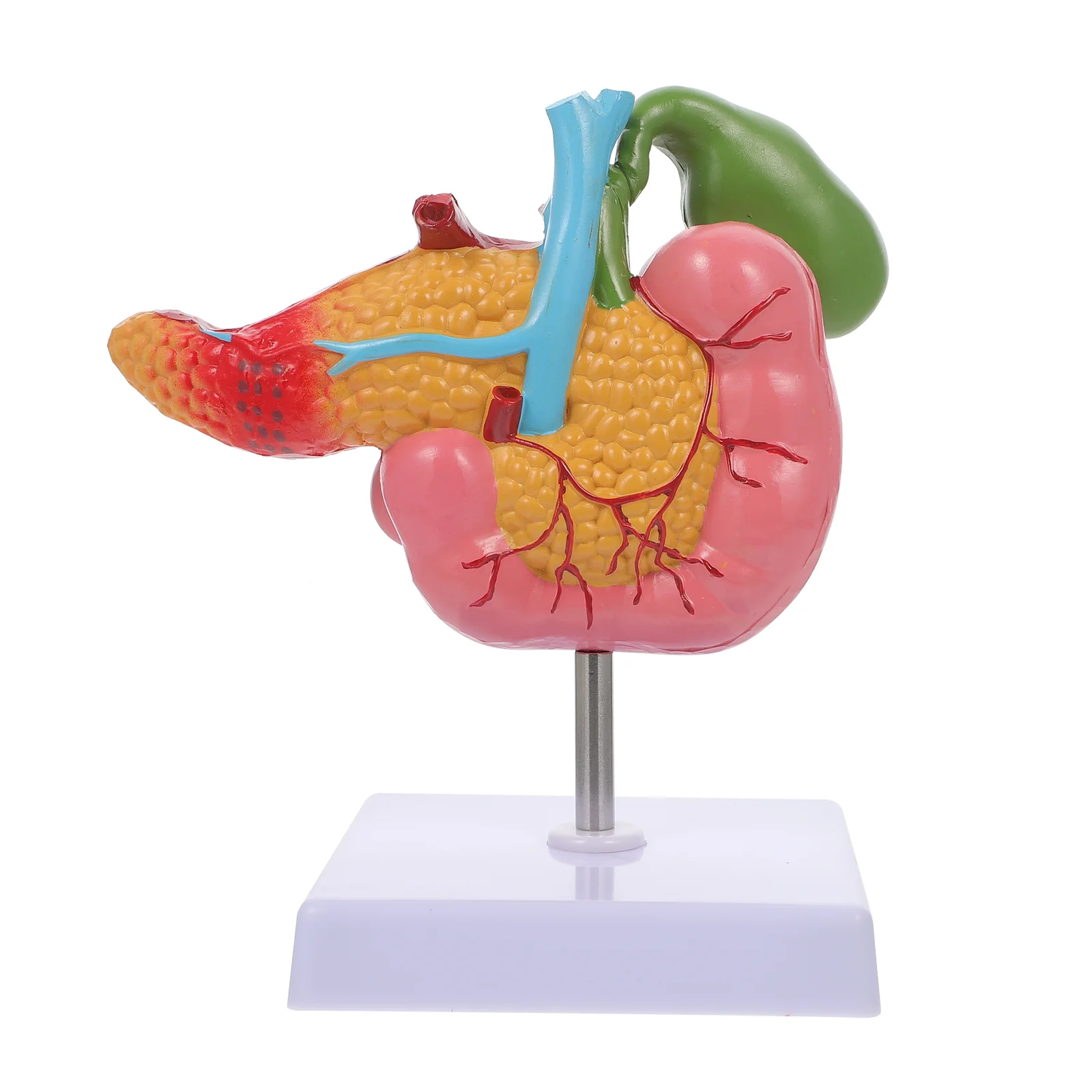 

Pathological Model Gallbladder Duodenal Teaching Instrument Duodenum Lesion Biology Pvc Spleen Lesions Human Pancreas