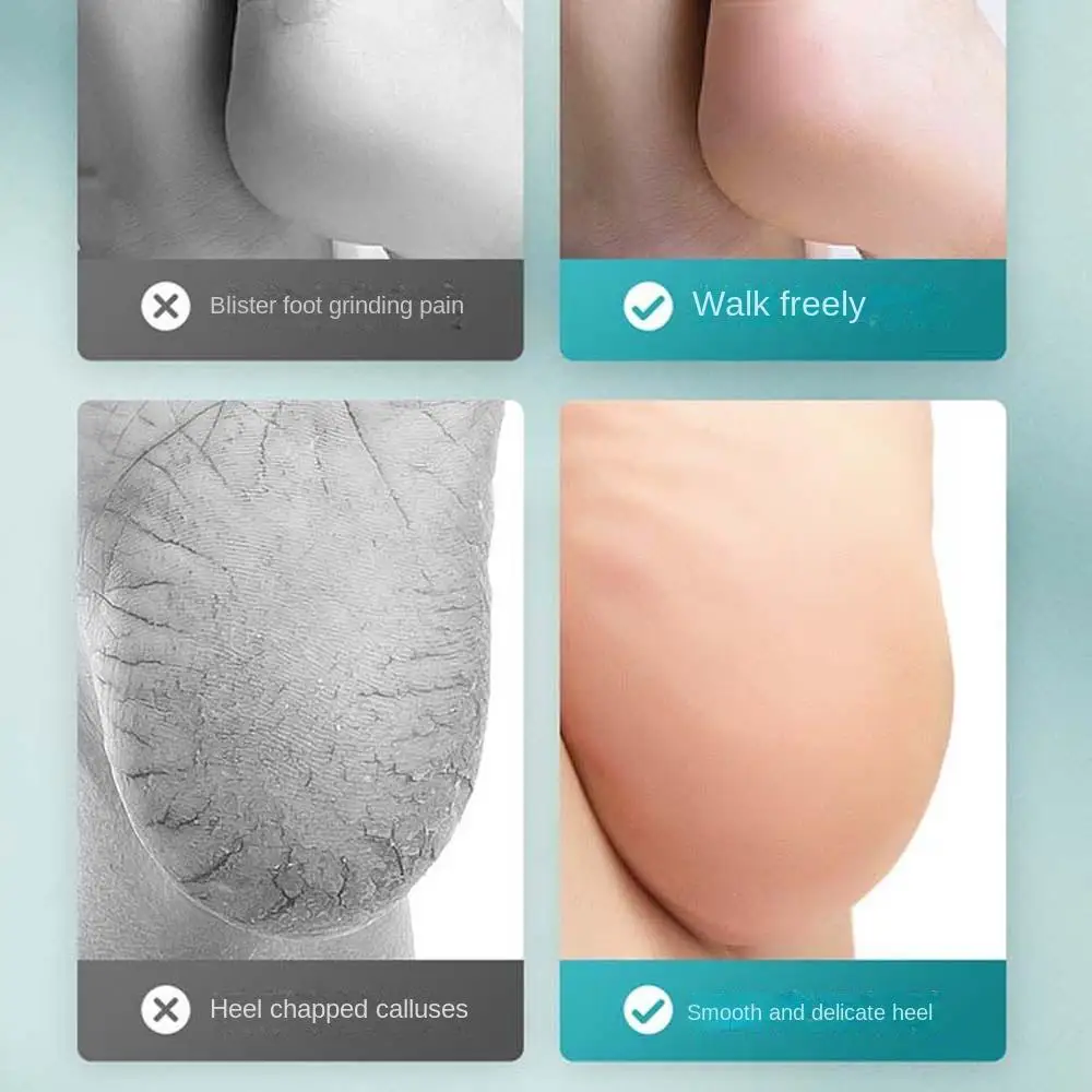 Защита для ног крем пяток антиблистер рельезивное боли бальзам палочка