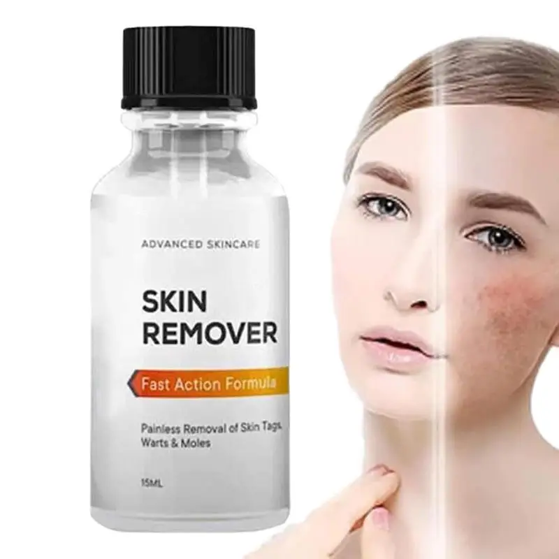 

Warts Removal Liquid Essence Skin Tags Remover And Repair Essence 15ml Natural Mole Removal Safe Hurtless For All Skin Types