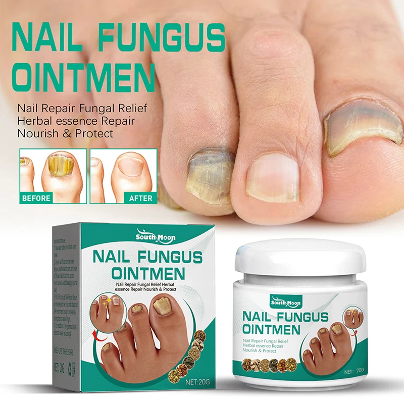 

20g Nail Fungus Treatment Removal Feet Care Cream Fungus Removal & Repair Gel Anti-Infection Parasitic Diseases Mycosis